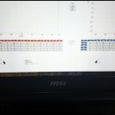 베스트보청기 이미지