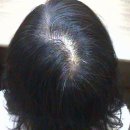 (주)엠지에프아이 | 춘천탈모 엠지에프 - '나' 자신을 위한 관리! 바로 지금입니다!! 40대 여성탈모 관리후기