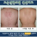 헐렁이