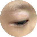 화이트라인하얀피부과 이미지