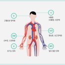 고혈압의 합병증 이미지