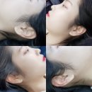 구미신평중학교 | [구미 왁싱 시술만족도1위 &#39;뷰티쏘유&#39;] 브라질리언 구렛나루 제모 남자 여자 임산부 왁싱전문샵