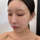 유아이 | 대구 여드름관리 범어동 에스테틱 유아이 에스테틱 후기