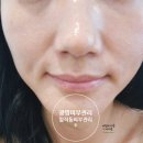 광명 피부관리 건강한 스킨케어 스며들다 방문 후기