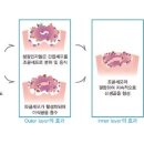 (주)유쾌한메디컬 네이버블로그