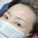 정쌤피부이야기 | 홍대 깔끔한 잔흔 커버로 눈썹을 소생시켜 드려요