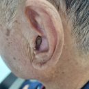 화명독일보청기 이미지