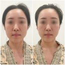 아산 탕정 피부관리 살롱드코지 리프팅 효과 개만족스러운 후기