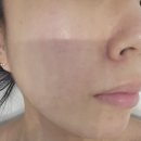 마리나베이 | 효천지구 피부관리, 행암동 페이스관리 탄력 미백에 효과! 얼굴 특수케어 !!