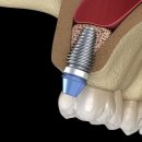서울라미플란트치과교정과치과의원 이미지