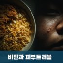 성화우리약국 | 울산공업탑피부과 , 비만이 피부 트러블에 미치는 영향, 신정동 더치유의원