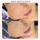 (주)벨벳케어 네이버블로그