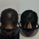 채오름SMP 이미지