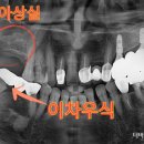 잘씹는치과의원 이미지