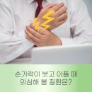 이준희내과의원 | 방아쇠수지증후군 치료 안내 [서면 류마이준희내과의원]