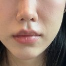 중동 시청앞 육교밑 | 부천 중동 윤곽관리 서아담 에스테틱 비대칭부터 홍조까지 잡는 수기관리 후기
