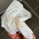 NR-3[평화로]-하-800 | [39주 5일] 초산모 진통 7시간 후 응급제왕 출산 후기 (태반조기박리, 이슬비침 사진 O)