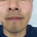 제이비비 동탄점 | 그루밍남의 첫번째 조건, 관리 받기! 제이비비 동탄점 트라이엄 레이저 후기