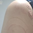 충주정형외과의원 네이버블로그