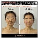 하계동필라테스 매직필라테스 두골비.체 얼굴축소 체형교정 시설 리뷰