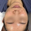 늘빛뷰티 네이버블로그