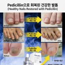 페디실린 풀 케어 솔루션 이미지