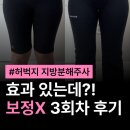 더탄탄병원 | 강남다이어트병원 허벅지 지방분해주사 효과 3회차 내돈내산 후기