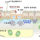 장누수 증후군 이미지