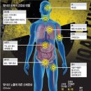 ‘방사능’ 막기 위한 요오드화칼륨 방사선 걱정 없다?(한국경제) 이미지