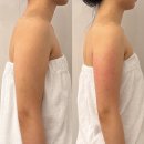 대동씨코아경로당 | 마산피부관리 쎌뷰티 | 댓거리피부관리 여리핏 팔뚝 관리 받고 온 후기