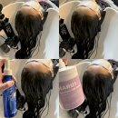 카로레더 | 부평 두피케어 탈모전문 “헤어나올수없어” 르미네상스 모발클리닉 후기