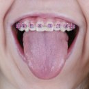 부평유디치과의원 이미지