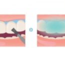 원데이치과의원 이미지