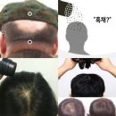 천안아산SMP두피탈모커버 장단점비교