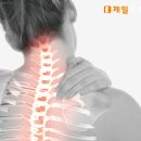 제일신경외과 네이버블로그