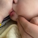 한땀성형외과의원 | [정자동 한땀성형외과의원]아기 입술 찢어졌을때,(주말 ,야간 성형외과,병원)