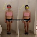 [강남체형관리 후기] 단 1회 관리로 목·어깨 통증 완화! 직접 경험한 리얼 변화