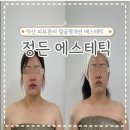 남중동-35 | 익산 피부관리 정든에스테틱 땅콩형 얼굴관리후기