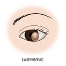 하이으나 이미지