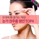 눈가 잔주름 원인 Top4 이미지