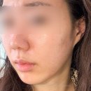 성수피부관리 미율에스테틱 리프팅 &amp; 순환관리코스 후기