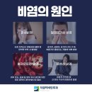 더원이비인후과 네이버블로그