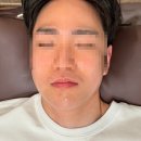 [일산 미모부심 에스테틱] 주엽동 왁싱ㅣ남성 인중·턱 깔끔함이 달라지는 미모 부심 왁싱 후기