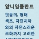 동두천치과 앞니임플란트후기, 추천 지행수치과