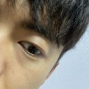 오창김안과의원 이미지