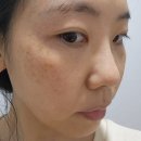 헤르세 - 과천시 | 헤르세디아 PDRN마스크팩 후기 진정마스크팩으로 수분충전 완료