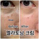 멜라토닝 크림 (광고x 두달사용후기 내돈내산 동아제약 기미크림 주근깨 색소침착 크림)