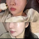 김기옥스킨케어 | 김포운양동 피부관리 김기옥 스킨케어 물방울리프팅 후기