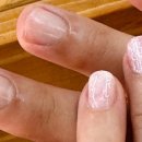 Nail Story