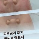 석산프라자 | 요즘 내 피부 난리 났잖아? 곽민정 석산피부관리 급하게 다녀온 썰 푼다